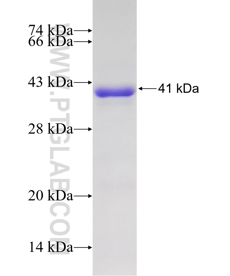 NADK fusion protein Ag8117 SDS-PAGE NADK fusion protein Ag8117 SDS-PAGE
