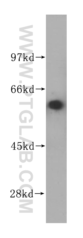 WB analysis of human kidney using 14863-1-AP