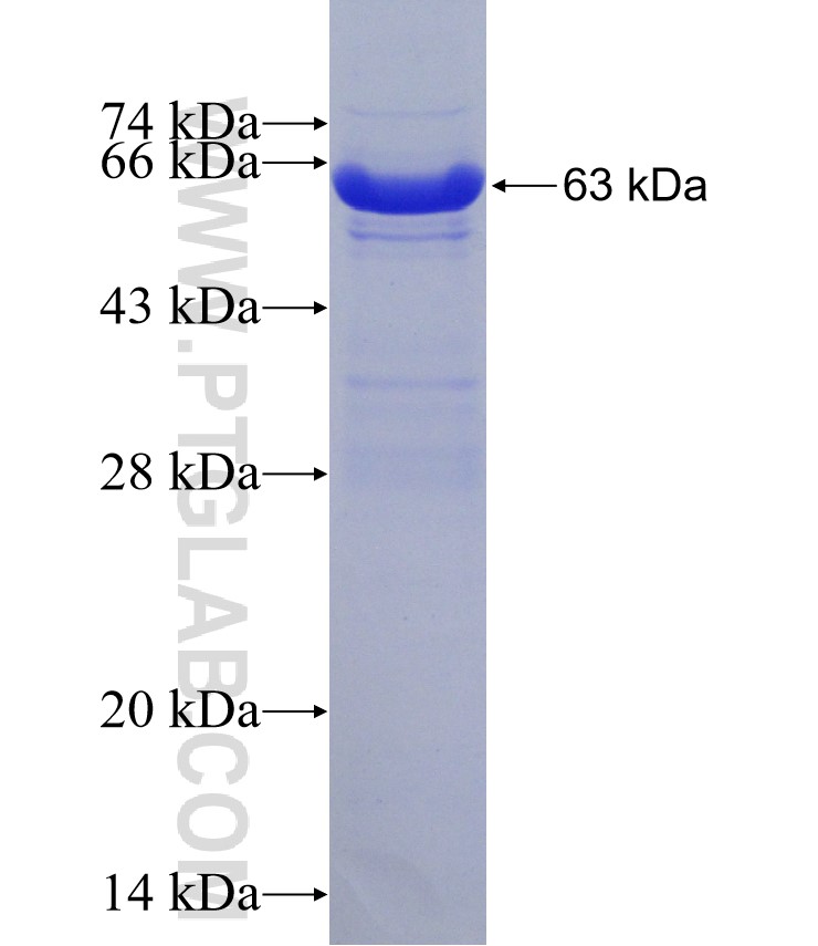 NAGK fusion protein Ag7034 SDS-PAGE