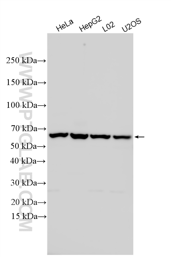 WB analysis using 31365-1-AP (same clone as 31365-1-PBS) WB analysis using 31365-1-AP (same clone as 31365-1-PBS)