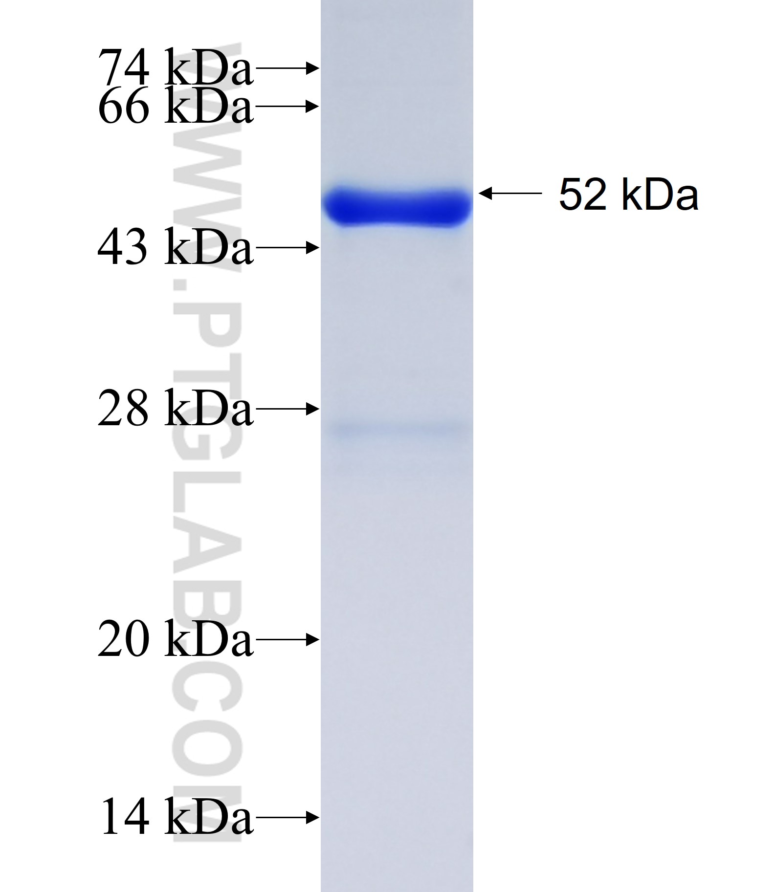 NAGPA fusion protein Ag34860 SDS-PAGE