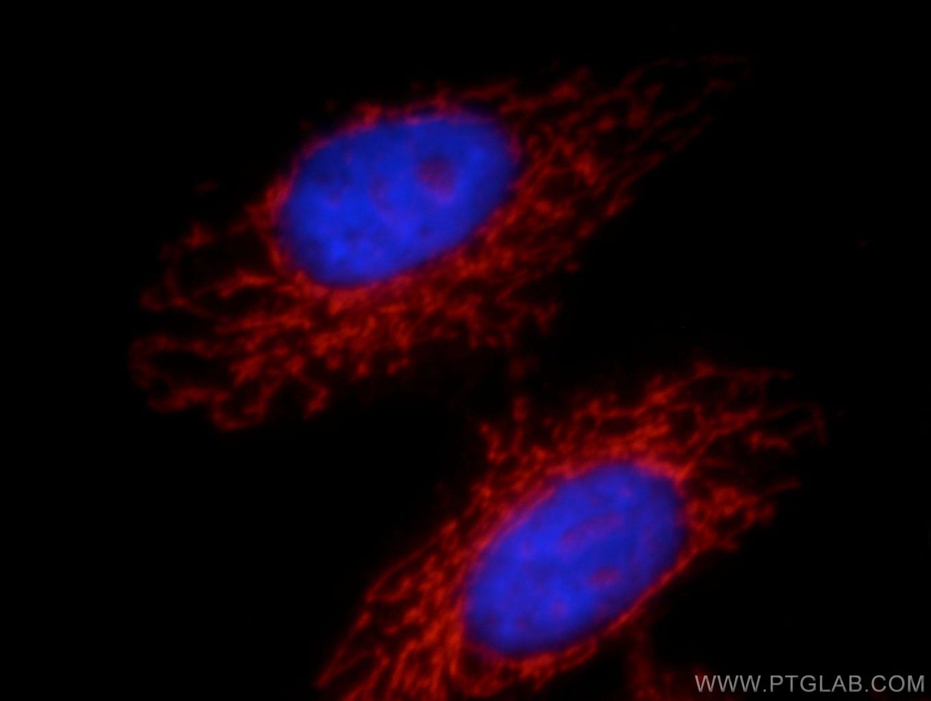 IF Staining of HepG2 using 21566-1-AP