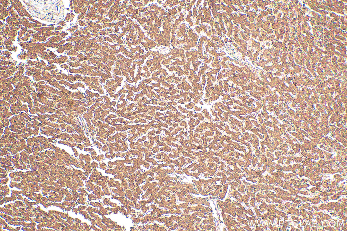 Immunohistochemical analysis of paraffin-embedded human liver tissue slide using 21566-1-AP (NAGS antibody) at dilution of 1:200 (under 10x lens). Heat mediated antigen retrieval with Tris-EDTA buffer (pH 9.0). IHC staining of human liver using 21566-1-AP