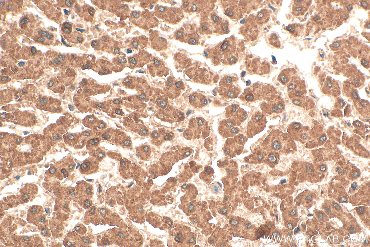 Immunohistochemical analysis of paraffin-embedded human liver tissue slide using 21566-1-AP (NAGS antibody) at dilution of 1:200 (under 40x lens). Heat mediated antigen retrieval with Tris-EDTA buffer (pH 9.0). IHC staining of human liver using 21566-1-AP