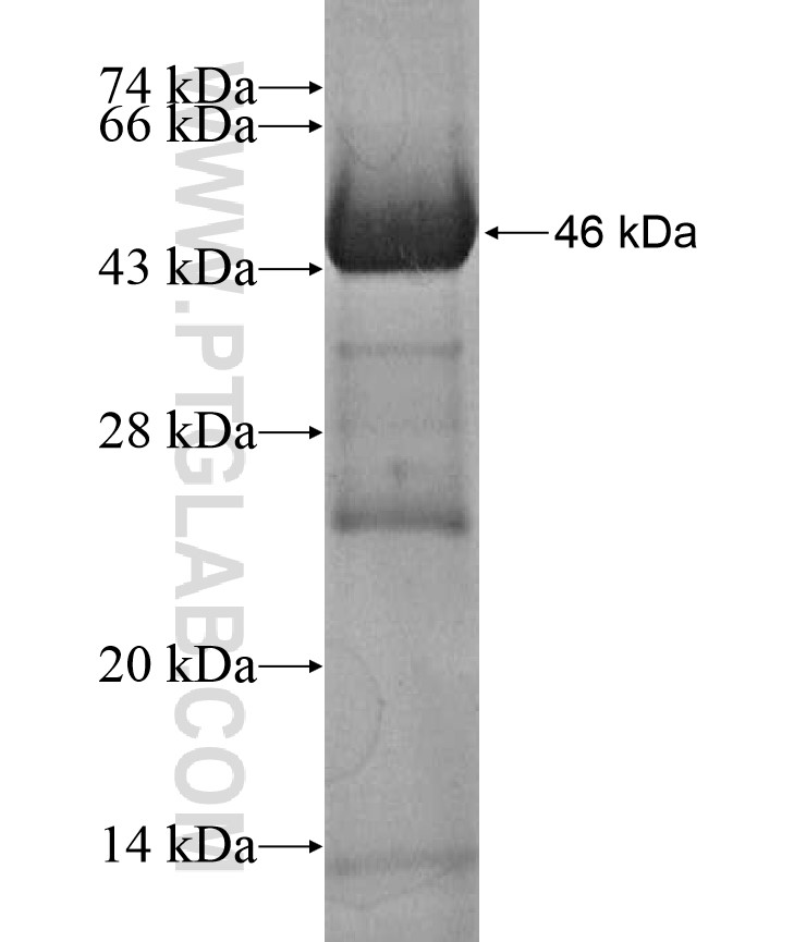 NAGS fusion protein Ag17348 SDS-PAGE NAGS fusion protein Ag17348 SDS-PAGE
