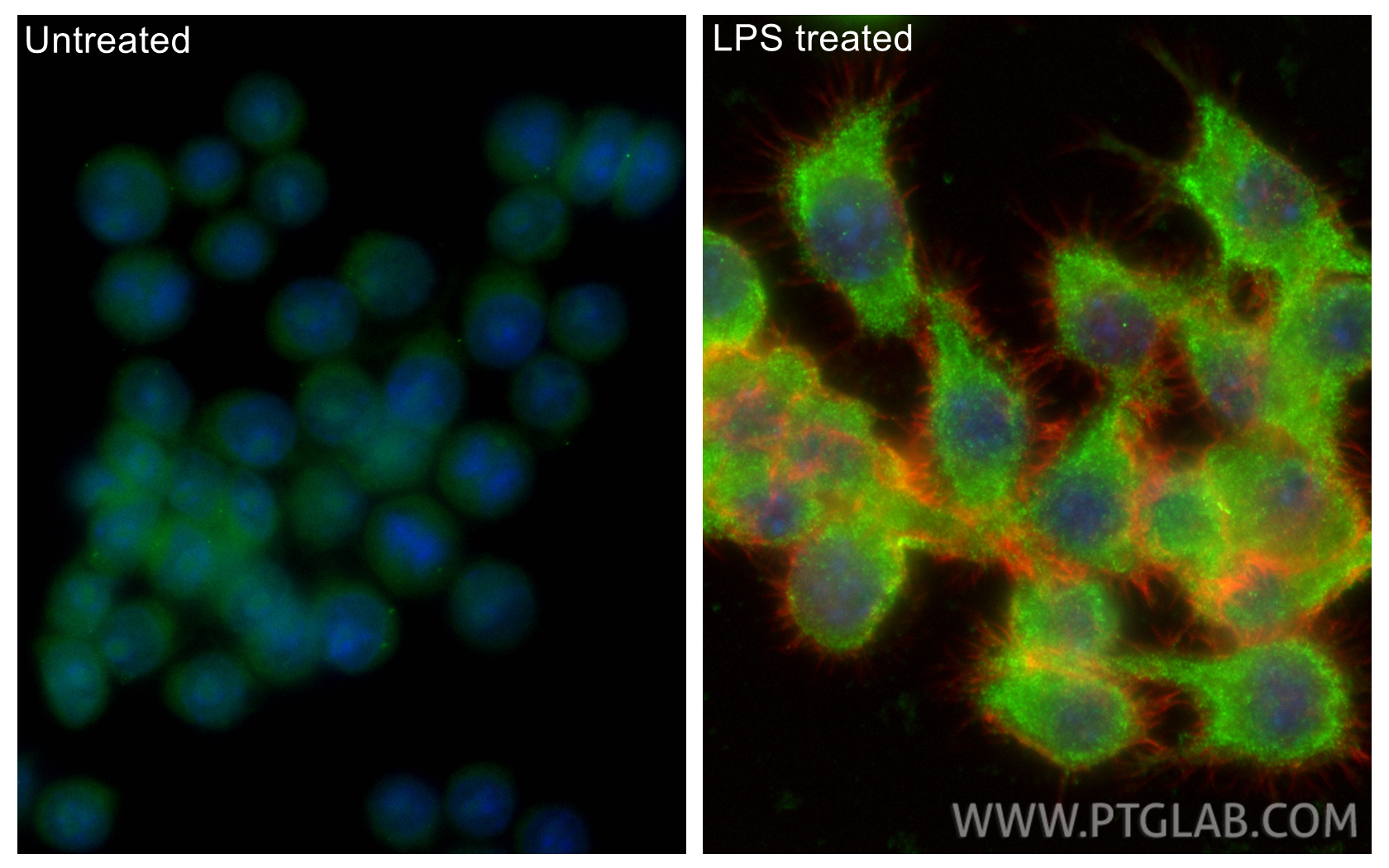 IF Staining of RAW 264.7 using 19771-1-AP IF Staining of RAW 264.7 using 19771-1-AP
