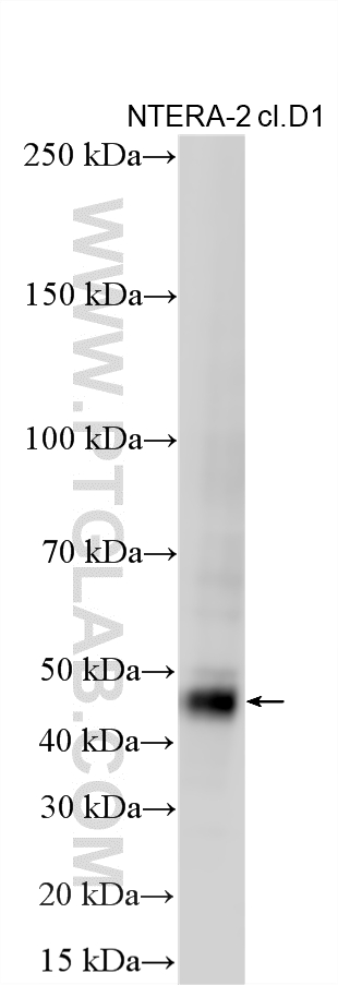 WB analysis using 14295-1-AP WB analysis using 14295-1-AP