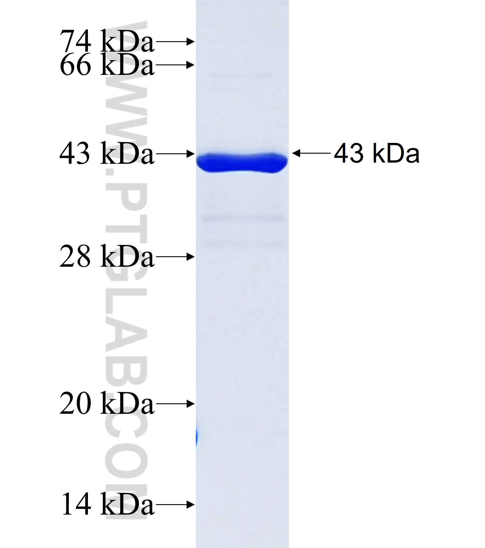 NANOS2 fusion protein Ag37122 SDS-PAGE NANOS2 fusion protein Ag37122 SDS-PAGE