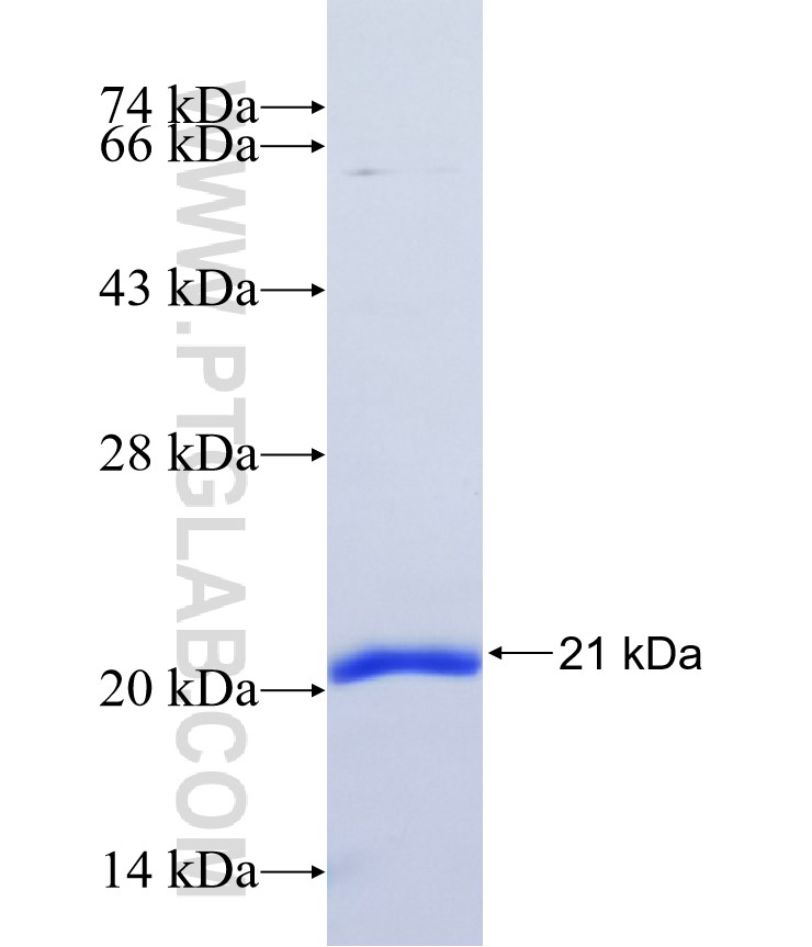 NANOS2 fusion protein Ag37352 SDS-PAGE NANOS2 fusion protein Ag37352 SDS-PAGE