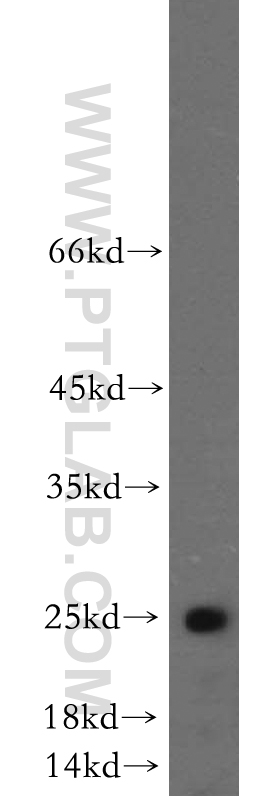 WB analysis of mouse testis using 21679-1-AP