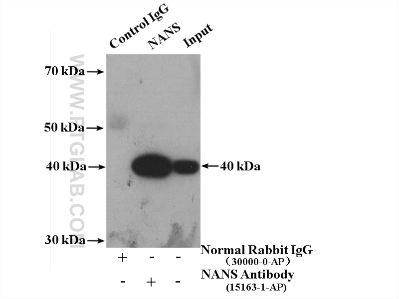 IP experiment of HepG2 using 15163-1-AP