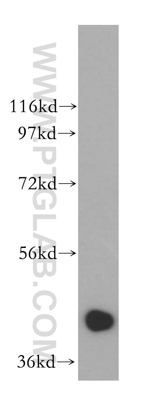 WB analysis of HeLa using 15163-1-AP