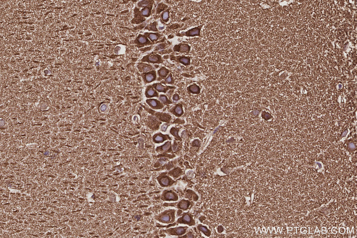 IHC staining of rat brain using 85142-2-RR