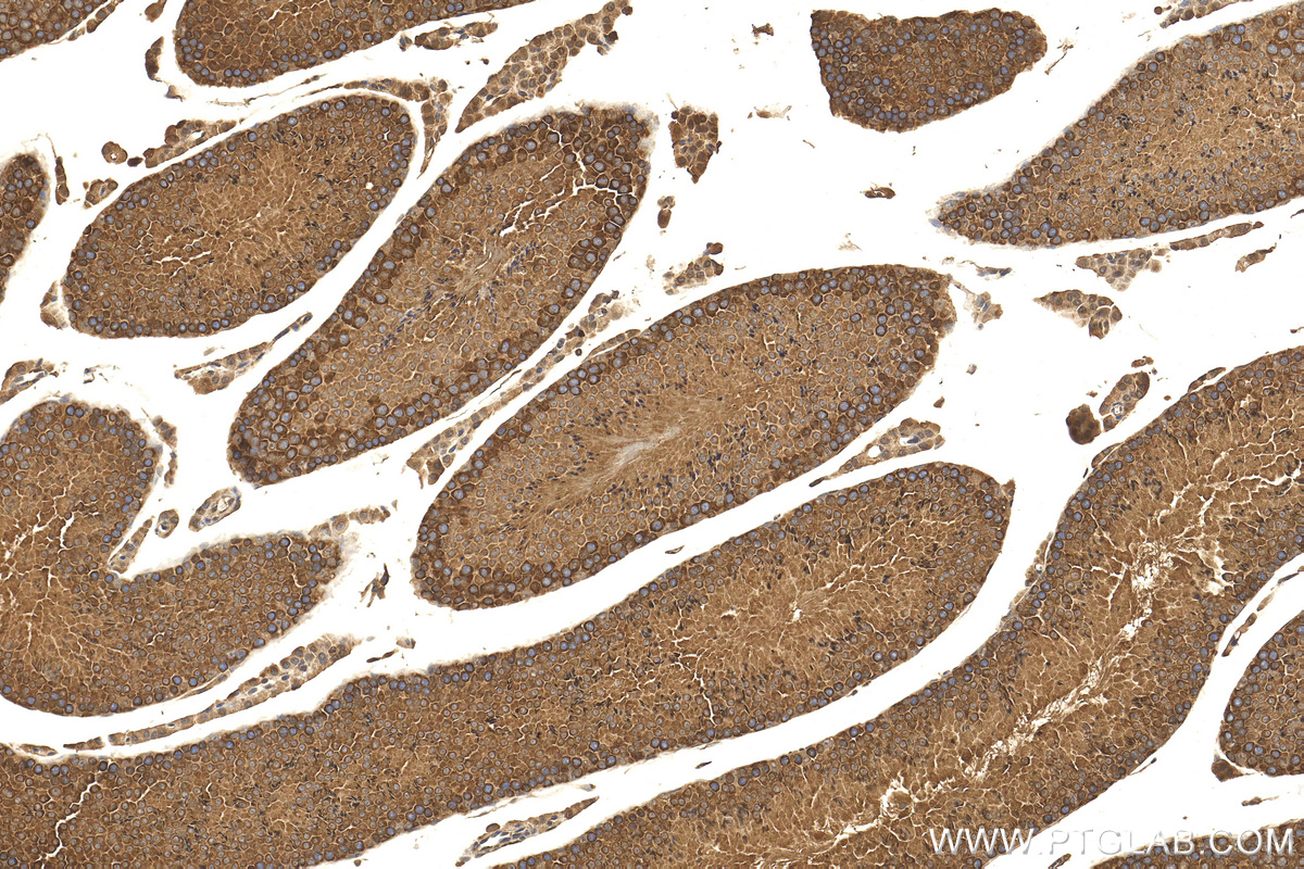 IHC staining of mouse testis using 14898-1-AP