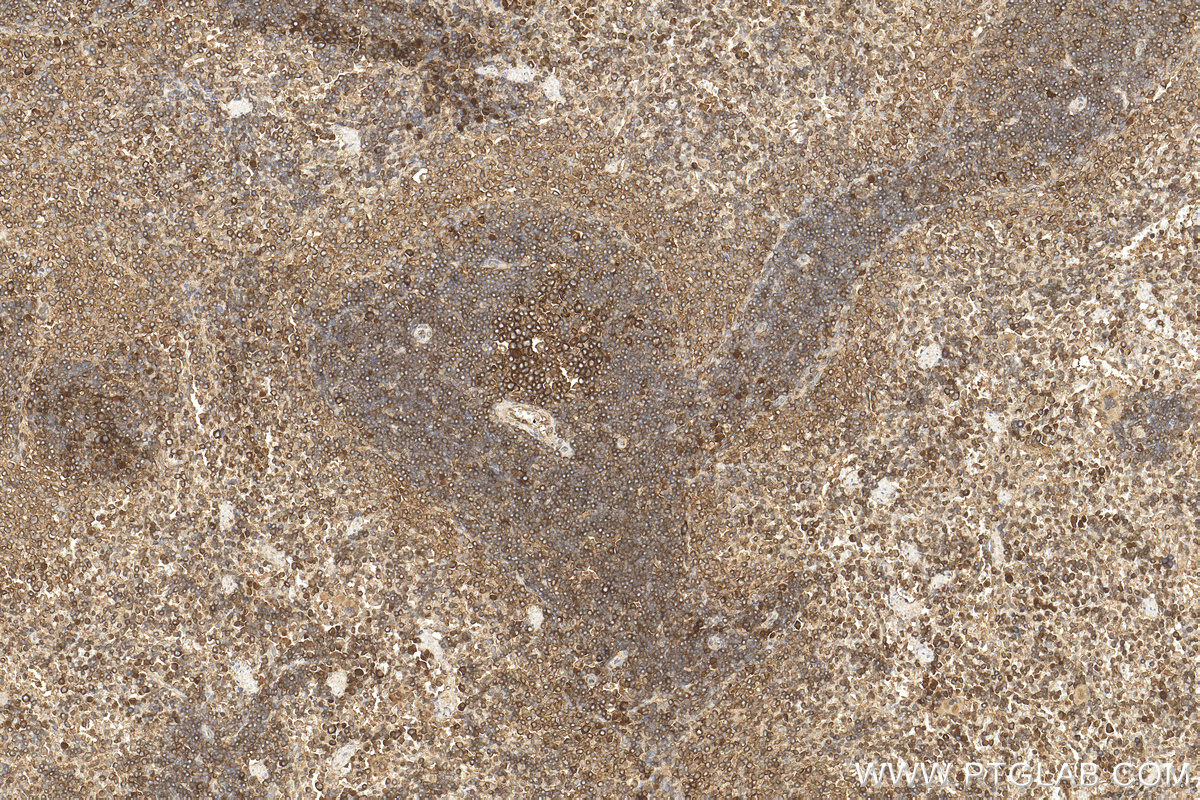 IHC staining of rat spleen using 14898-1-AP