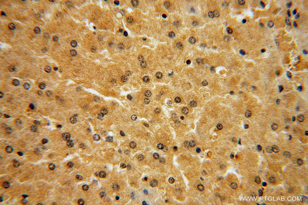 IHC staining of human liver using 16018-1-AP