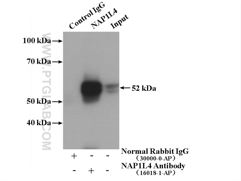 IP experiment of HeLa using 16018-1-AP