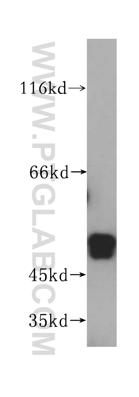 WB analysis of HeLa using 16018-1-AP