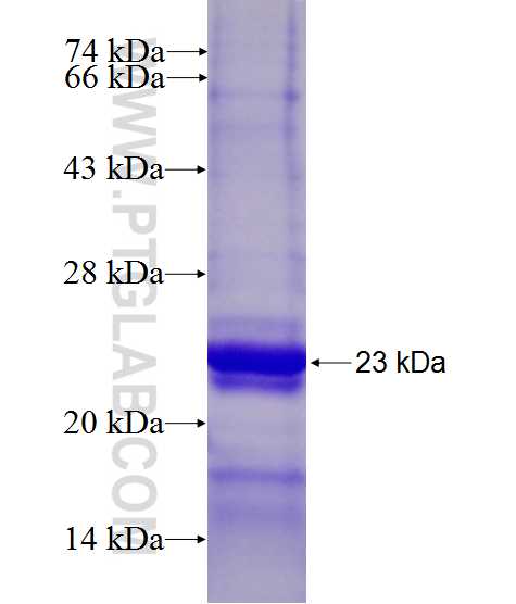 NAP1L4 fusion protein Ag27413 SDS-PAGE NAP1L4 fusion protein Ag27413 SDS-PAGE