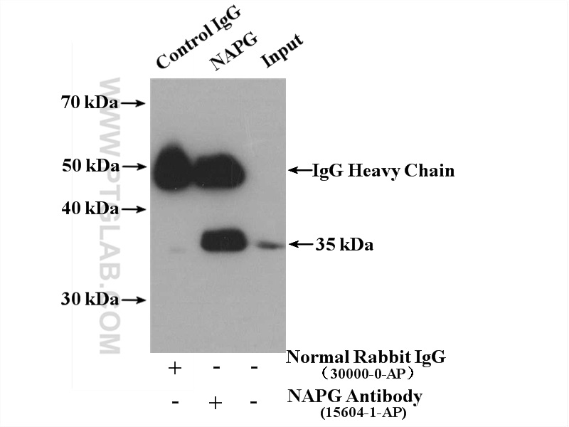 IP experiment of HepG2 using 15604-1-AP