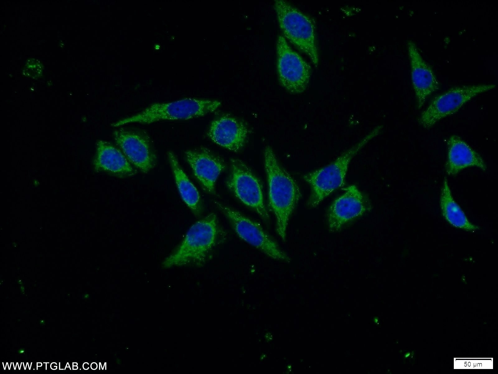 IF Staining of PC-3 using 16558-1-AP