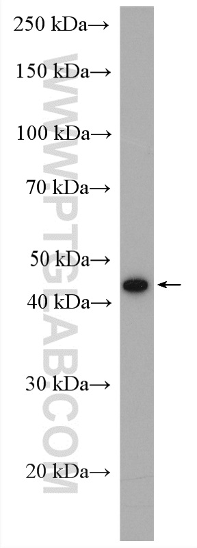 WB analysis of mouse lung using 16558-1-AP