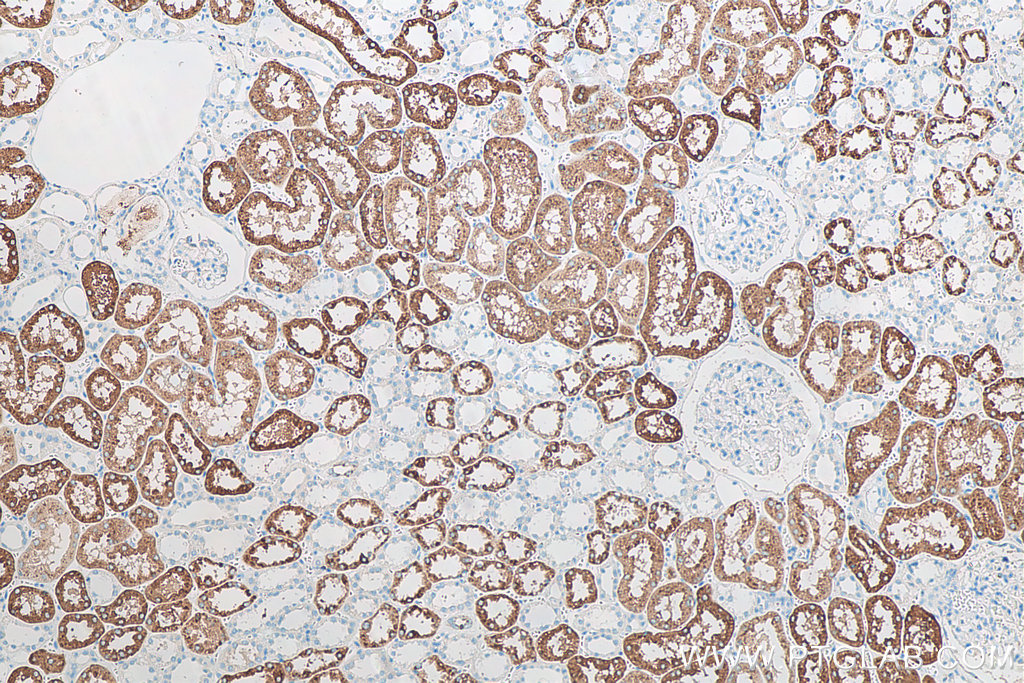 IHC staining of human kidney using 60259-2-Ig (same clone as 60259-2-PBS)