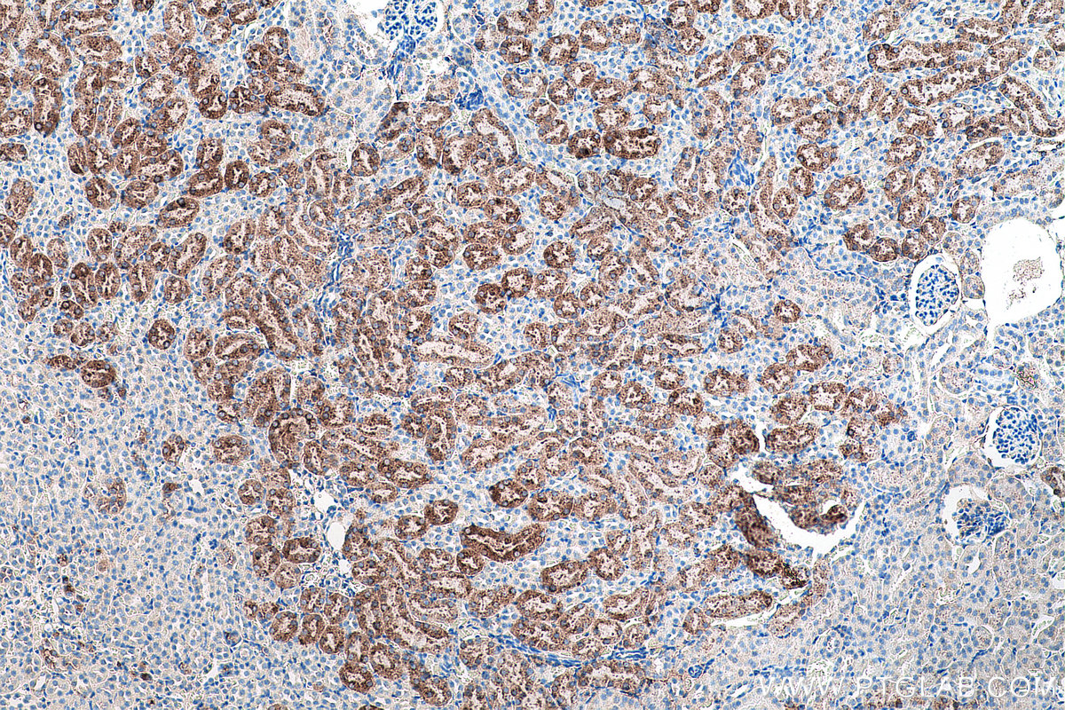 IHC staining of mouse kidney using 60259-2-Ig IHC staining of mouse kidney using 60259-2-Ig