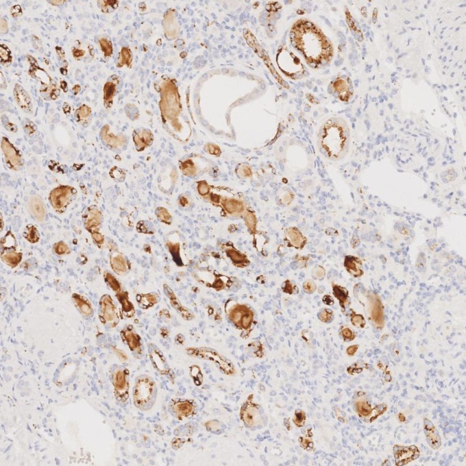 IHC staining of human kidney using 60259-2-Ig IHC staining of human kidney using 60259-2-Ig