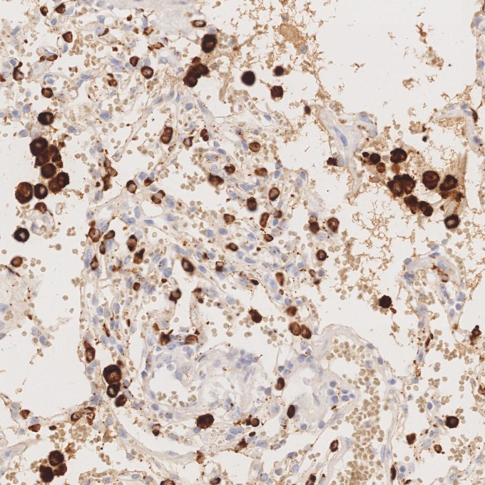 IHC staining of human lung using 60259-2-Ig IHC staining of human lung using 60259-2-Ig