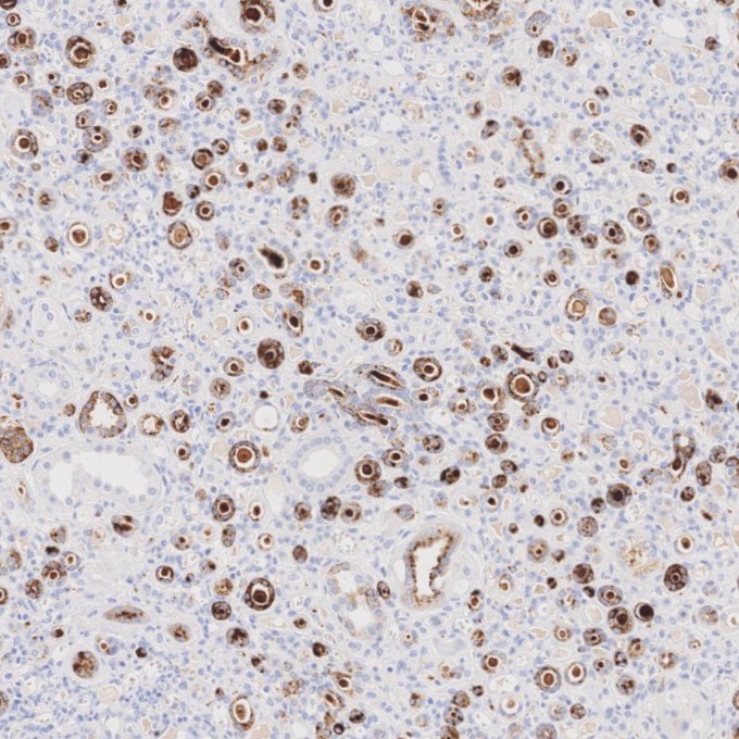 IHC staining of human kidney using 60259-2-Ig IHC staining of human kidney using 60259-2-Ig