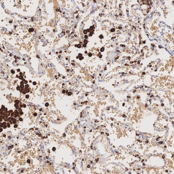 IHC staining of human lung using 60259-2-Ig IHC staining of human lung using 60259-2-Ig