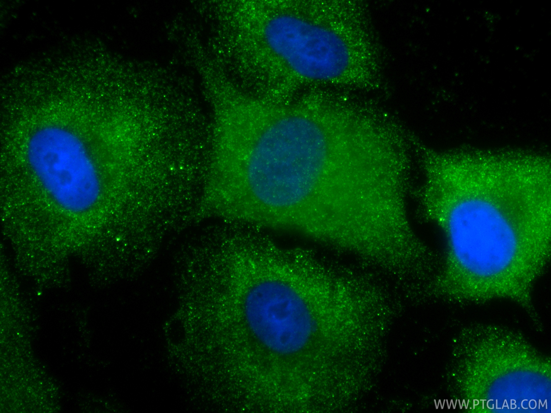 IF Staining of A549 using 86052-4-RR (same clone as 86052-4-PBS) IF Staining of A549 using 86052-4-RR (same clone as 86052-4-PBS)