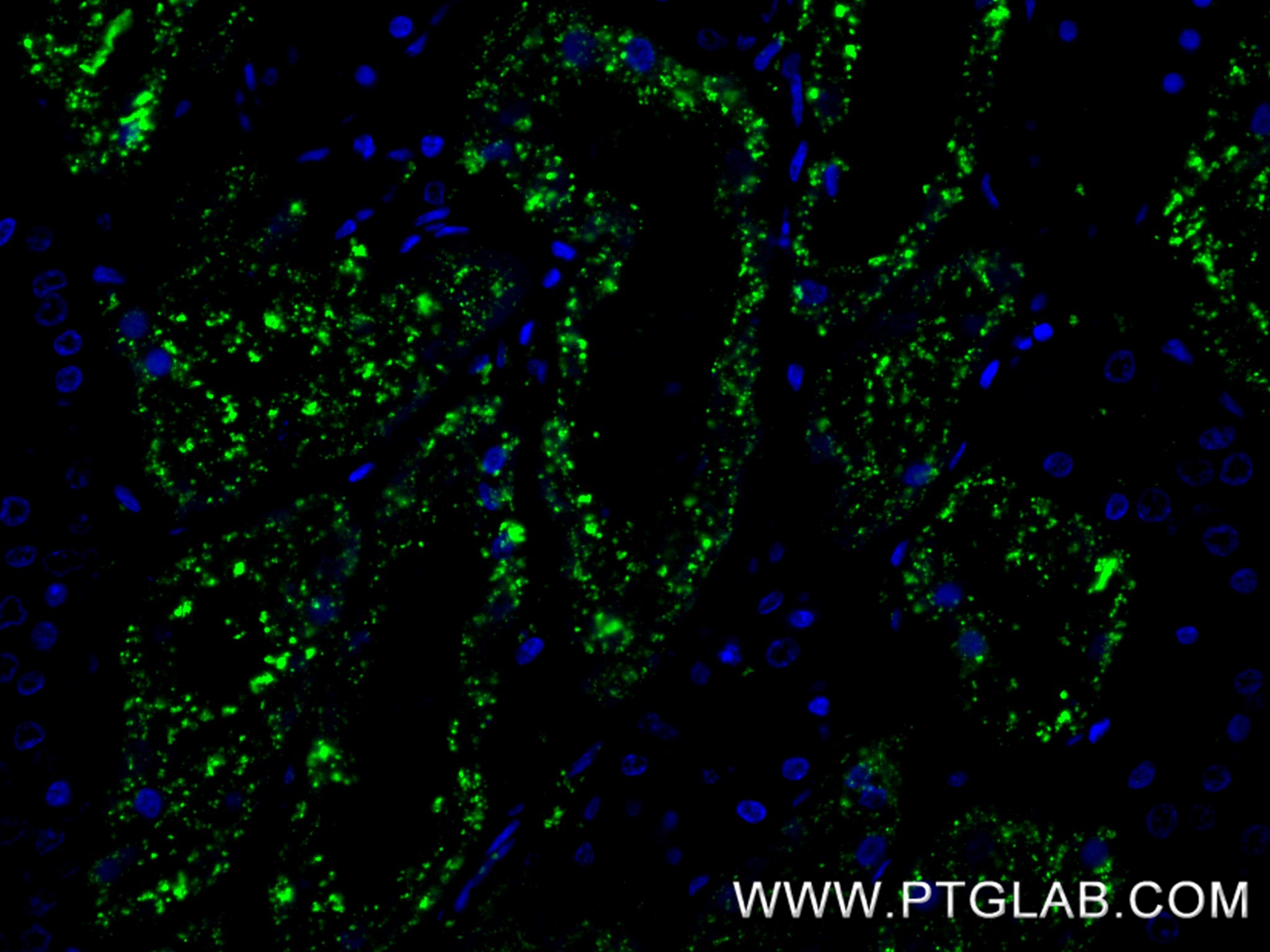 IF Staining of human kidney using 86052-4-RR IF Staining of human kidney using 86052-4-RR