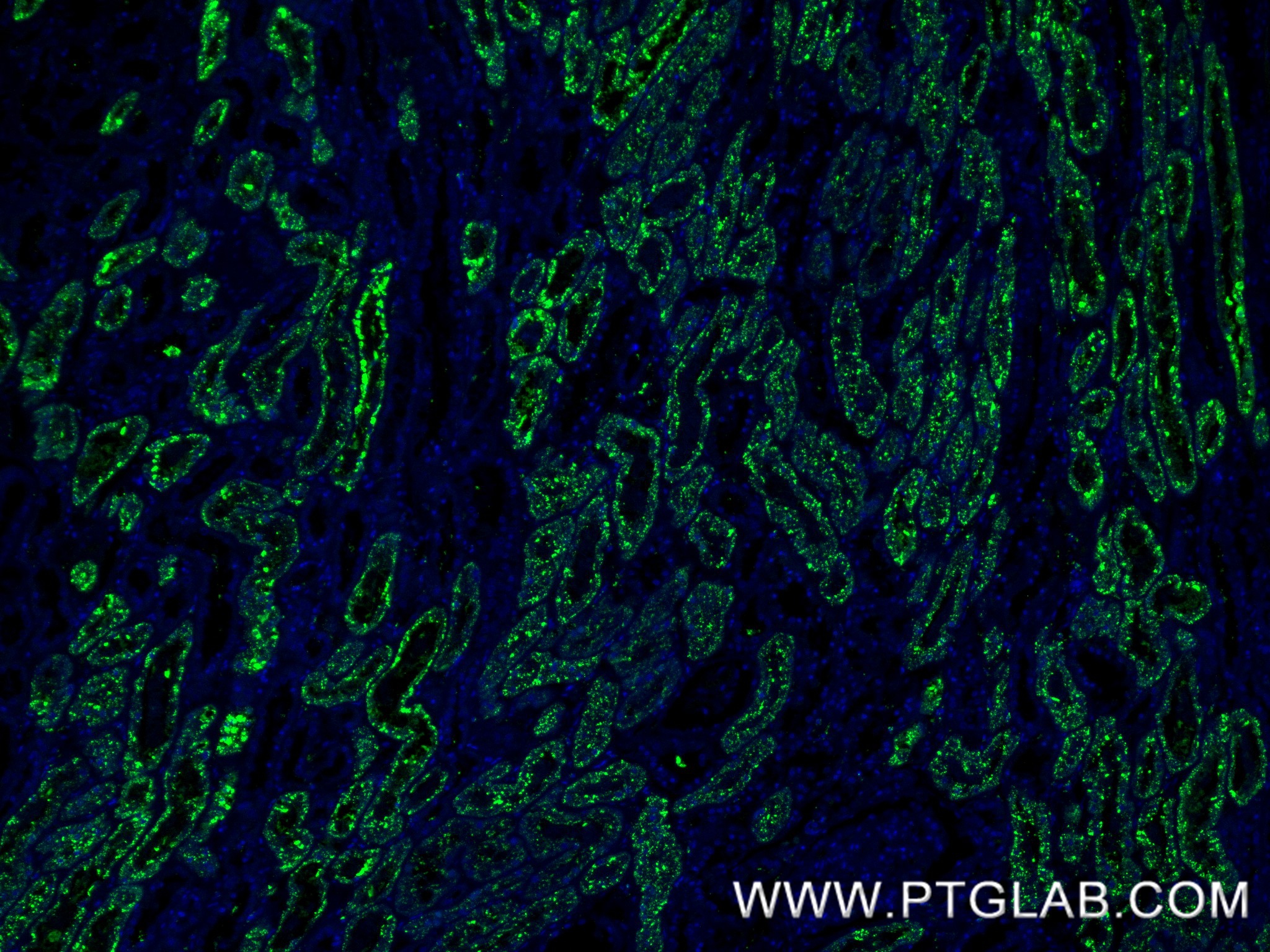 IF Staining of human kidney using 86052-4-RR IF Staining of human kidney using 86052-4-RR