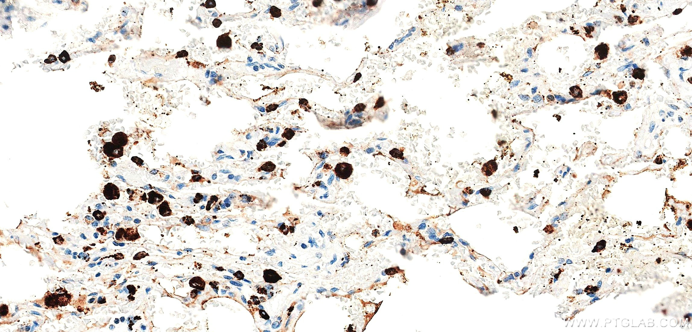 IHC staining of human lung using 86052-4-RR IHC staining of human lung using 86052-4-RR