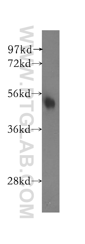 WB analysis of human liver using 12173-1-AP