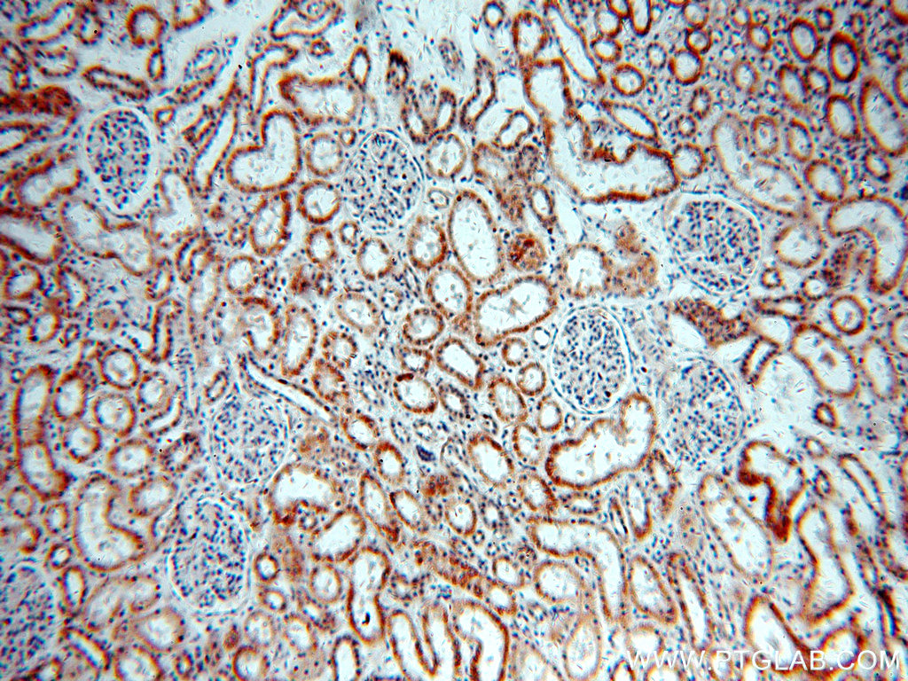IHC staining of human kidney using 20209-1-AP (same clone as 20209-1-PBS)