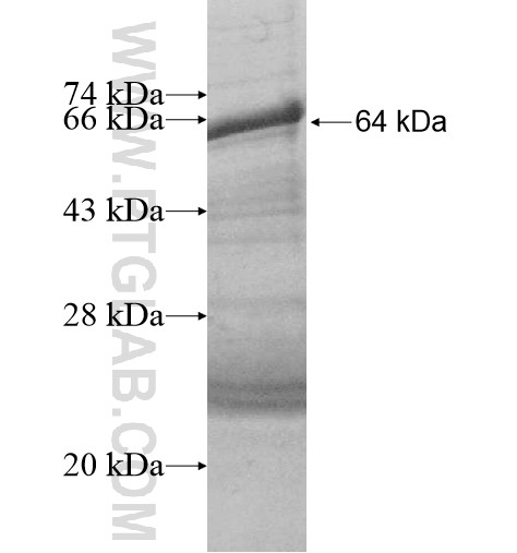 NARG1 fusion protein Ag13679 SDS-PAGE NARG1 fusion protein Ag13679 SDS-PAGE
