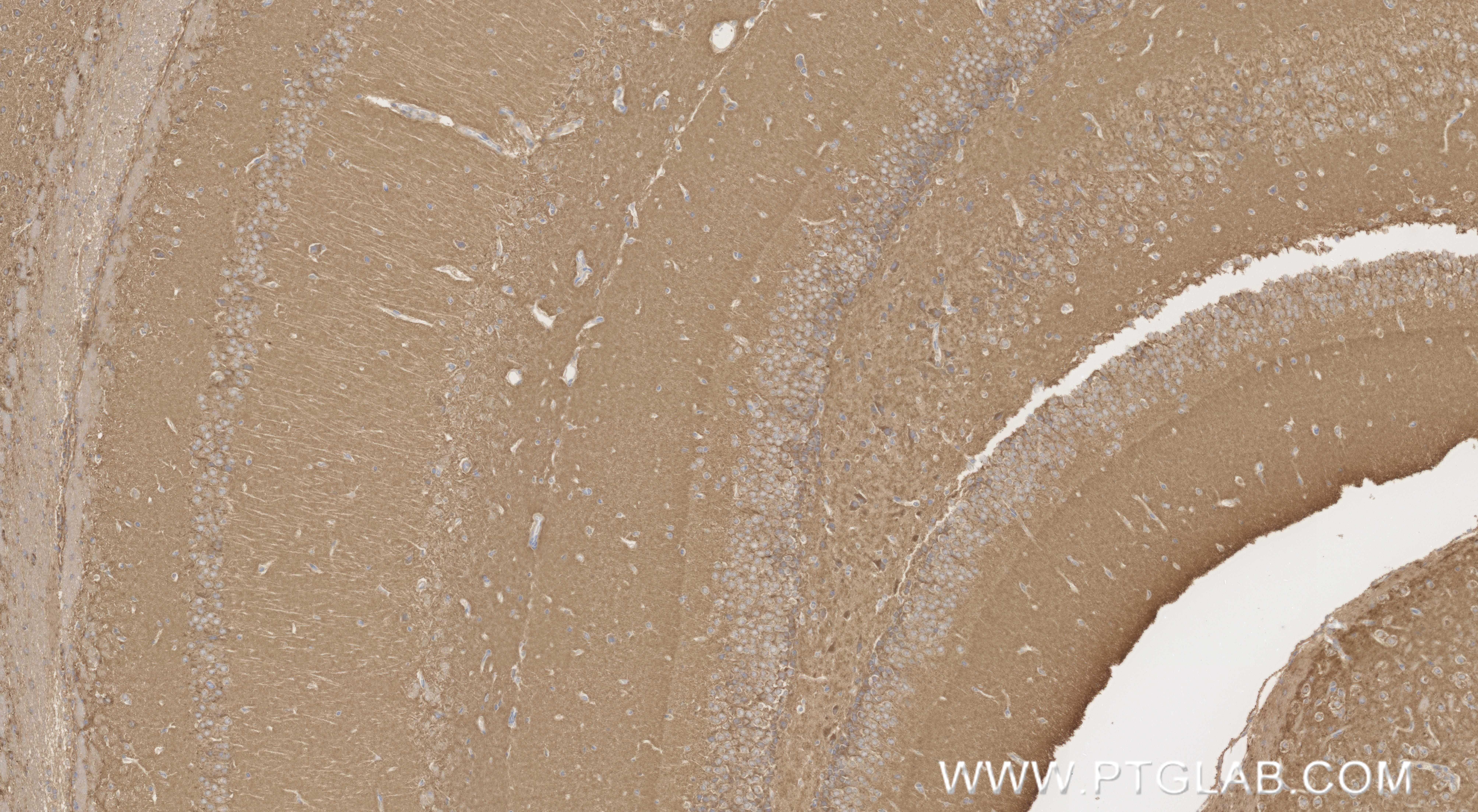 IHC staining of mouse brain using 85860-4-RR