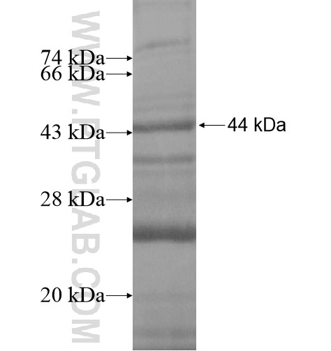 NARG1L fusion protein Ag11547 SDS-PAGE NARG1L fusion protein Ag11547 SDS-PAGE