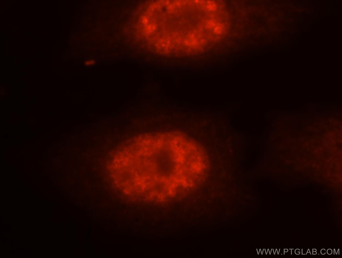 IF Staining of MCF-7 using 11323-1-AP
