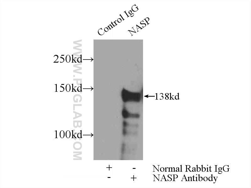 IP experiment of mouse testis using 11323-1-AP