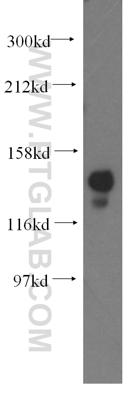 WB analysis of mouse testis using 11323-1-AP