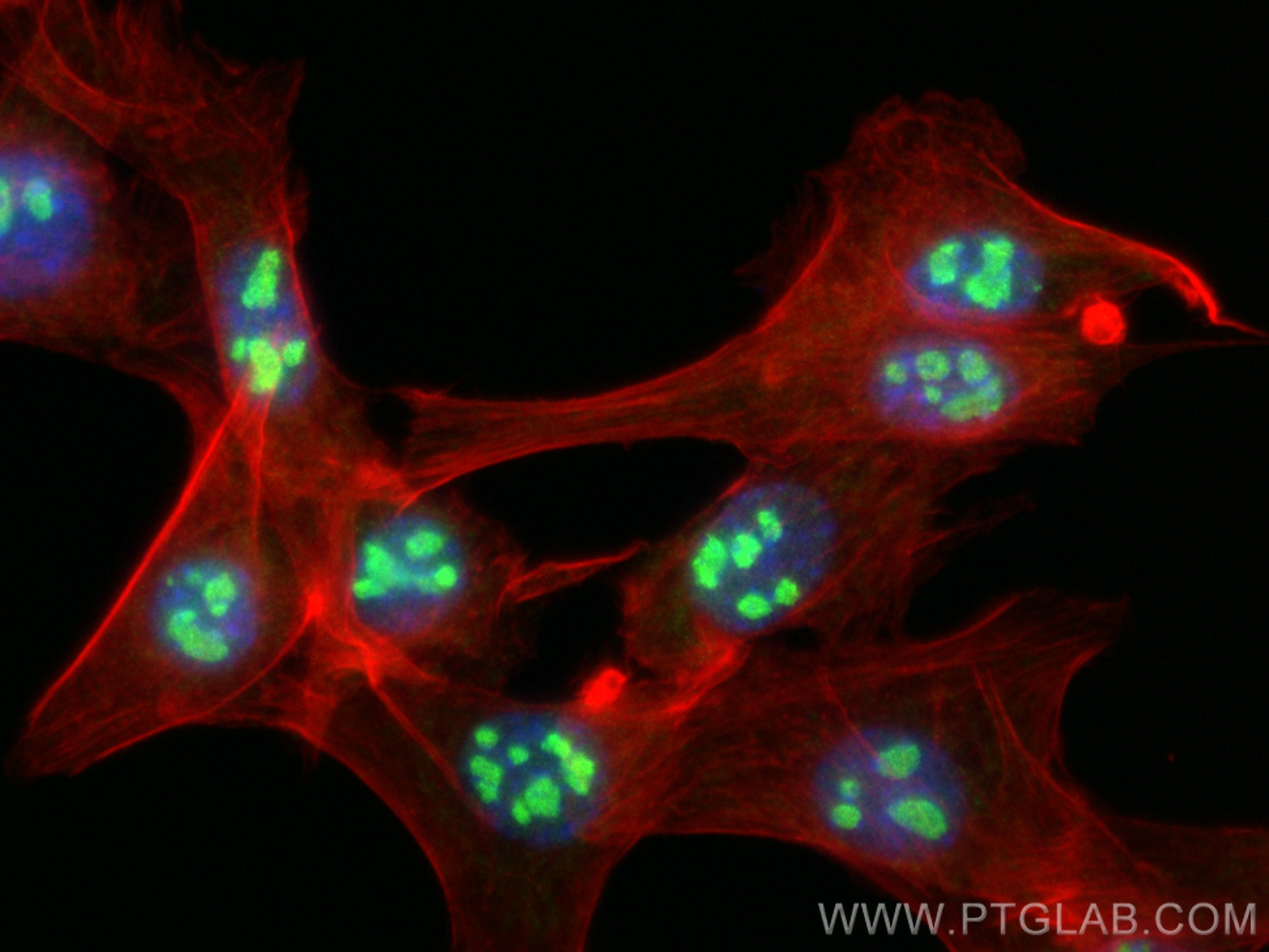 IF Staining of NIH/3T3 using 13365-1-AP