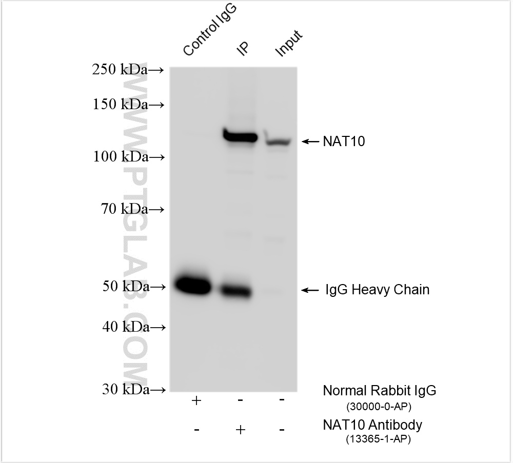 IP result of anti-NAT10 (IP:13365-1-AP, 4ug; Detection:13365-1-AP 1:30000) with HEK-293 cells lysate 1800 ug. IP experiment of HEK-293 using 13365-1-AP