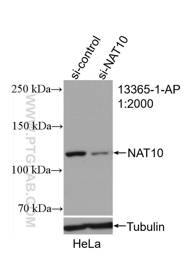 WB analysis of HeLa using 13365-1-AP