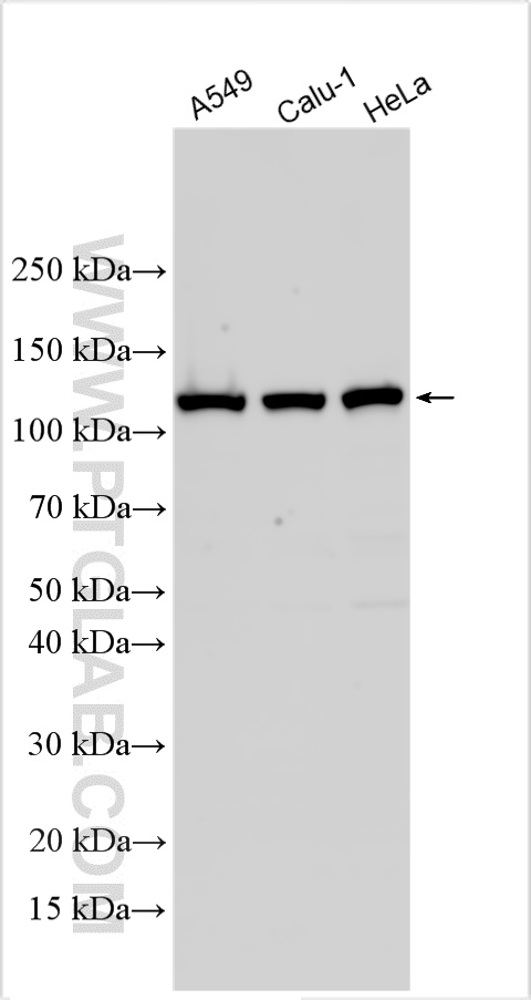 WB analysis using 13365-1-AP