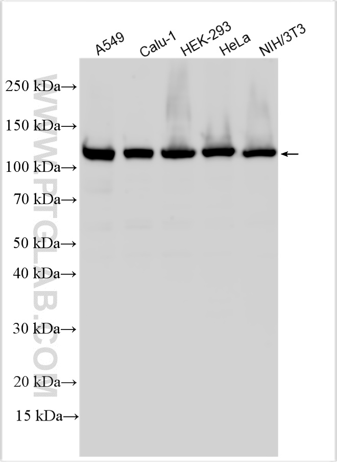 Various lysates were subjected to SDS PAGE followed by western blot with 13365-1-AP (NAT10 antibody) at dilution of 1:40000 incubated at room temperature for 1.5 hours. WB analysis using 13365-1-AP