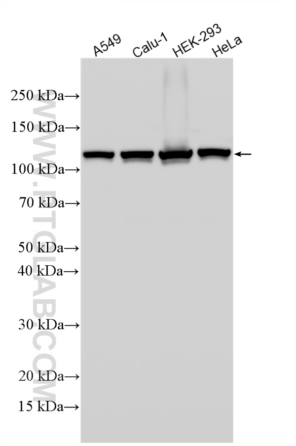 Various lysates were subjected to SDS PAGE followed by western blot with 13365-1-AP (NAT10 antibody) at dilution of 1:60000 incubated at room temperature for 1.5 hours. WB analysis using 13365-1-AP